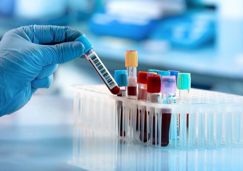 Health Screening Blood Tests