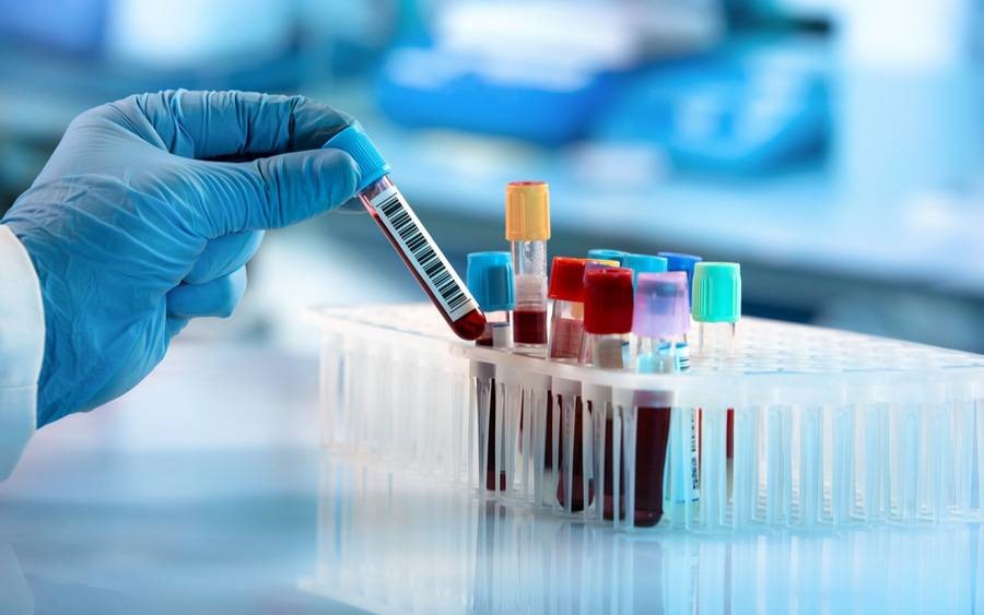 Health Screening Blood Tests