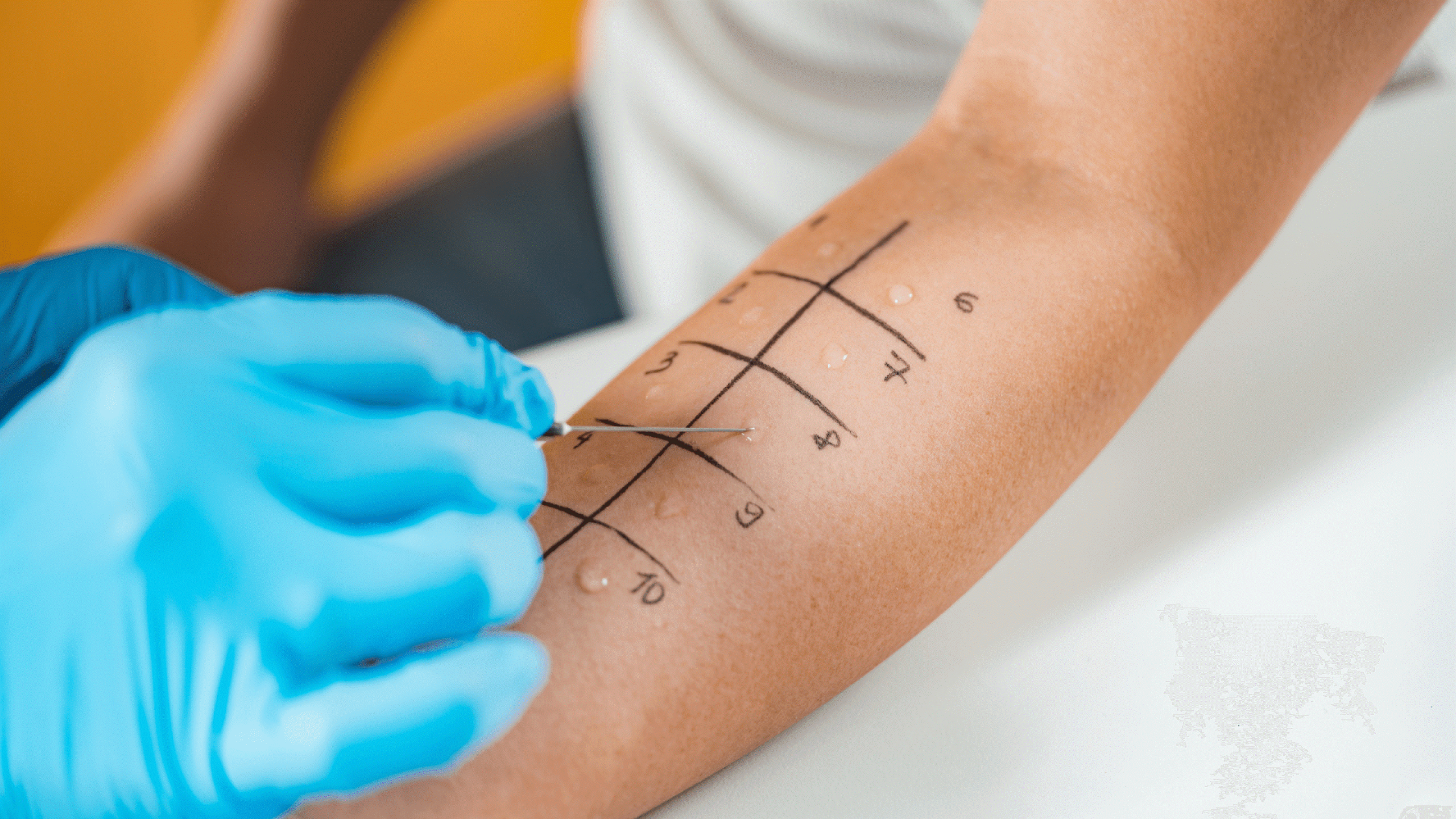 Allergy Testing Dublin
