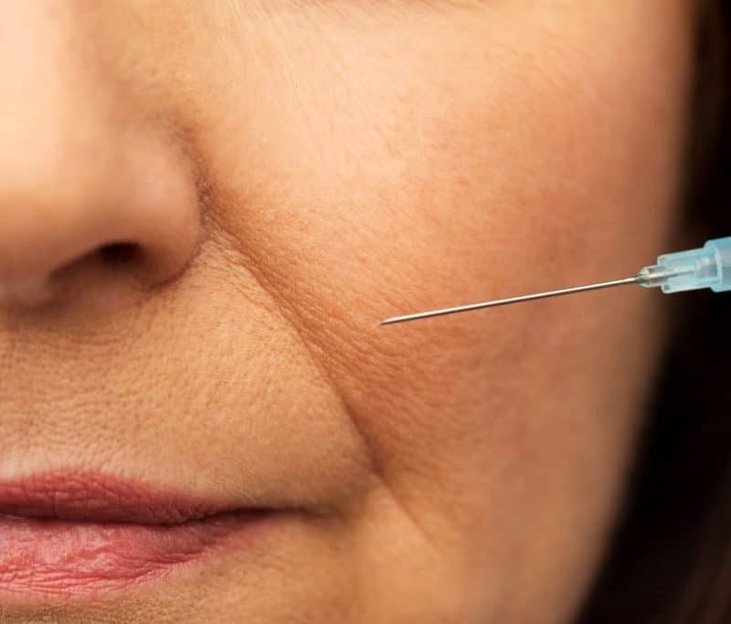 Anti-Wrinkle Injections
