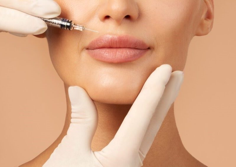 Dermal Filler Services in Ireland