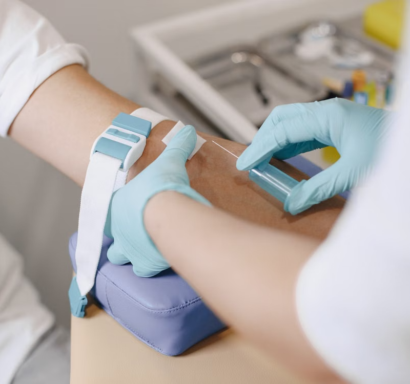 Blood Tests Dublin