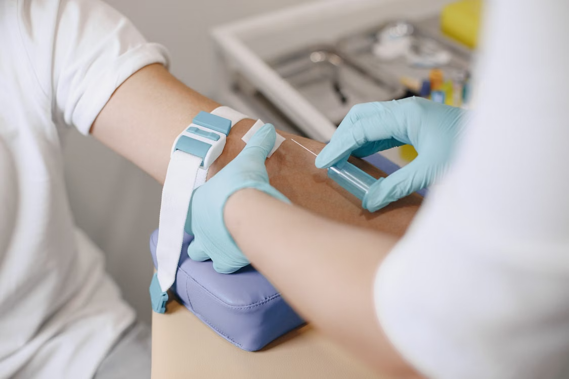Blood Tests Dublin