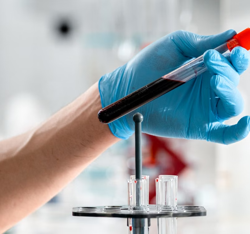 Blood Investigation Clinic