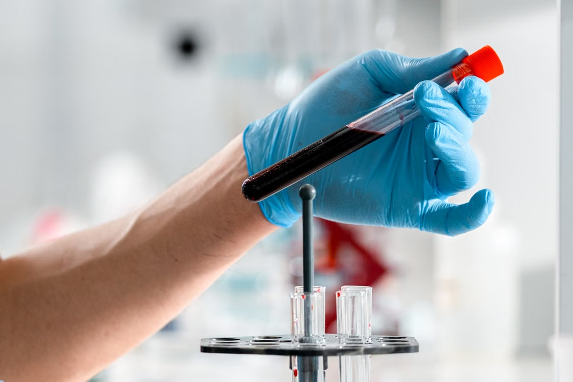Blood Investigation Clinic